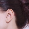 耳横の白ニキビを治す効果的な方法は？